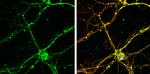 RAB26 Antibody in Immunocytochemistry (ICC/IF)