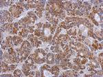 ZSWIM2 Antibody in Immunohistochemistry (Paraffin) (IHC (P))