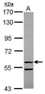 OASL Antibody in Western Blot (WB)