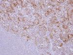 CALM Antibody in Immunohistochemistry (Paraffin) (IHC (P))