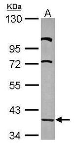 LDB2 Antibody in Western Blot (WB)