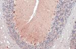 RAB11B Antibody in Immunohistochemistry (Paraffin) (IHC (P))