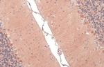 RAB11B Antibody in Immunohistochemistry (Paraffin) (IHC (P))