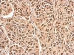 HRSP12 Antibody in Immunohistochemistry (Paraffin) (IHC (P))