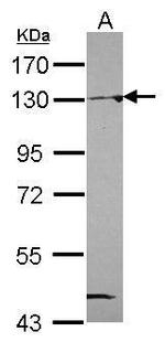 NAT10 Antibody in Western Blot (WB)