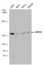 WDR19 Antibody in Western Blot (WB)