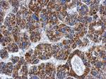 ADHFE1 Antibody in Immunohistochemistry (Paraffin) (IHC (P))