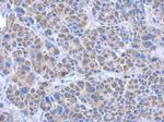 ADHFE1 Antibody in Immunohistochemistry (Paraffin) (IHC (P))