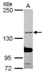 SALF Antibody in Western Blot (WB)