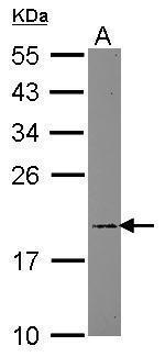 ARF5 Antibody in Western Blot (WB)