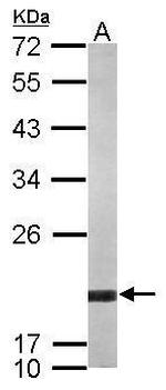 ARF5 Antibody in Western Blot (WB)