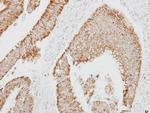 SERPINA4 Antibody in Immunohistochemistry (Paraffin) (IHC (P))