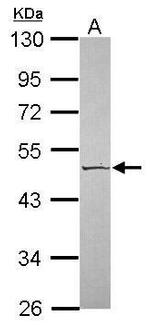 SERPINA4 Antibody in Western Blot (WB)