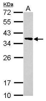 Calponin 2 Antibody in Western Blot (WB)