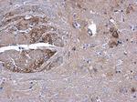 AAMP Antibody in Immunohistochemistry (Paraffin) (IHC (P))