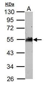 AAMP Antibody in Western Blot (WB)