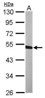 BCKDK Antibody in Western Blot (WB)