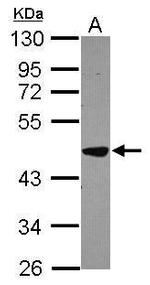 BCKDK Antibody in Western Blot (WB)