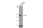 Myosin Skeletal Muscle Antibody in Western Blot (WB)