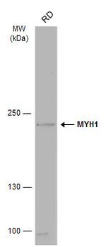 Myosin Skeletal Muscle Antibody in Western Blot (WB)