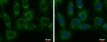 SARS2 Antibody in Immunocytochemistry (ICC/IF)