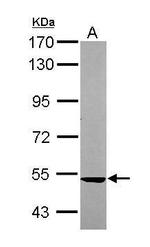 SARS2 Antibody in Western Blot (WB)