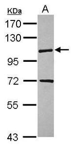 KIF18A Antibody in Western Blot (WB)