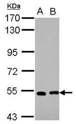 SMYD1 Antibody in Western Blot (WB)