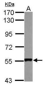 SMYD1 Antibody in Western Blot (WB)