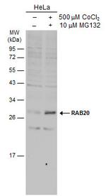 RAB20 Antibody in Western Blot (WB)