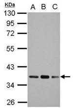 PDHB Antibody in Western Blot (WB)