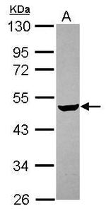 CHST4 Antibody in Western Blot (WB)