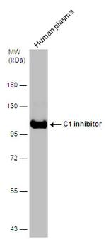 C1 inhibitor Antibody in Western Blot (WB)