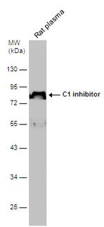 C1 inhibitor Antibody in Western Blot (WB)