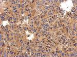 C1 inhibitor Antibody in Immunohistochemistry (Paraffin) (IHC (P))