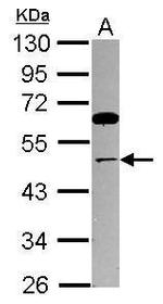 TRIP13 Antibody in Western Blot (WB)