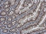 PYGO2 Antibody in Immunohistochemistry (Paraffin) (IHC (P))