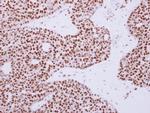 RAD50 Antibody in Immunohistochemistry (Paraffin) (IHC (P))