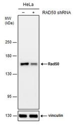 RAD50 Antibody