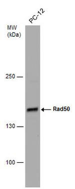 RAD50 Antibody in Western Blot (WB)