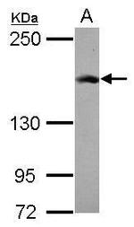 RAD50 Antibody in Western Blot (WB)