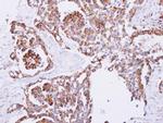 PITRM1 Antibody in Immunohistochemistry (Paraffin) (IHC (P))