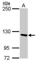 PITRM1 Antibody in Western Blot (WB)