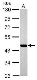 PABPC5 Antibody in Western Blot (WB)