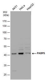 PABPC5 Antibody in Western Blot (WB)