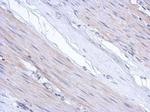 ABCF3 Antibody in Immunohistochemistry (Paraffin) (IHC (P))