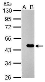 ZBTB24 Antibody in Western Blot (WB)