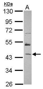 RBM17 Antibody in Western Blot (WB)