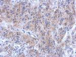 KATNAL1 Antibody in Immunohistochemistry (Paraffin) (IHC (P))