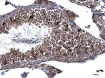 KATNAL1 Antibody in Immunohistochemistry (Paraffin) (IHC (P))